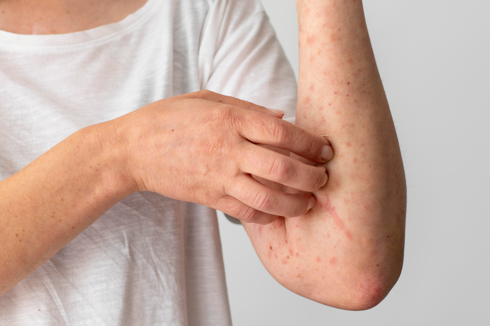 Skin Rash Symptoms: What to Know Before Seeing a Doctor